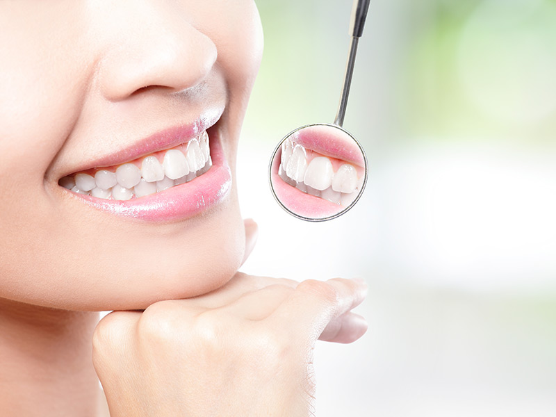 Teeth Whitening in Coral Gables