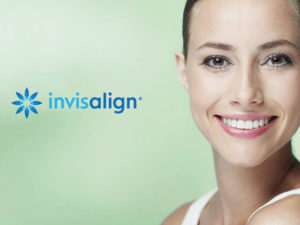 Invisalign in Coral Gables